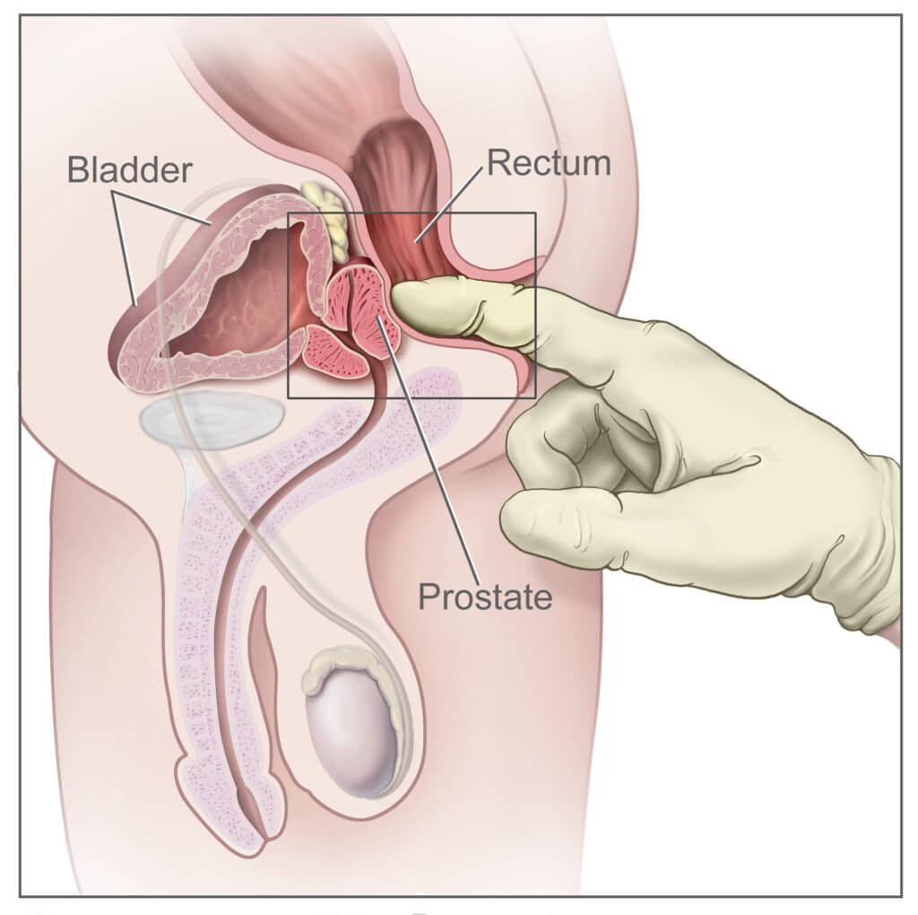 Prostate Drawing